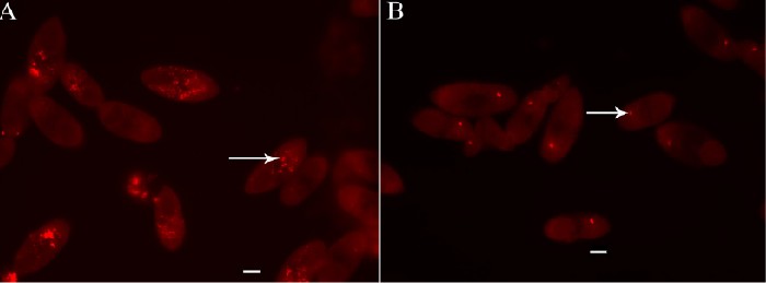 Обработка РНКазой теронтов I. multifiliis штамма G5. (A) Эндосимбионты, маркированные FISH пробой EUB338 (красный), отмечены стрелкой