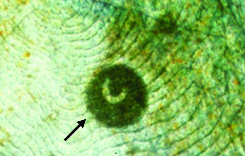Ichthyophthirius multifiliis (стрелка) с кожи культивируемого полосатого окуня.