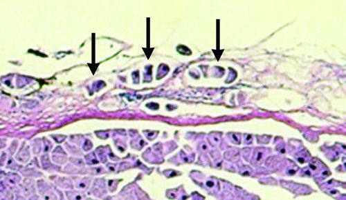 Инвазия Tetrahymena sp. через кожу полосатого окуня.