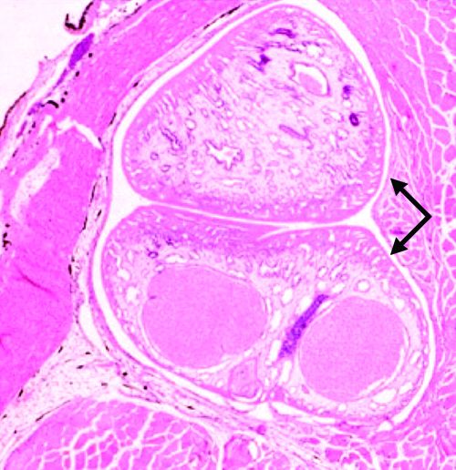Две личинки трематод (стрелки) в мышечной ткани выращенного в пруду полосатого окуня