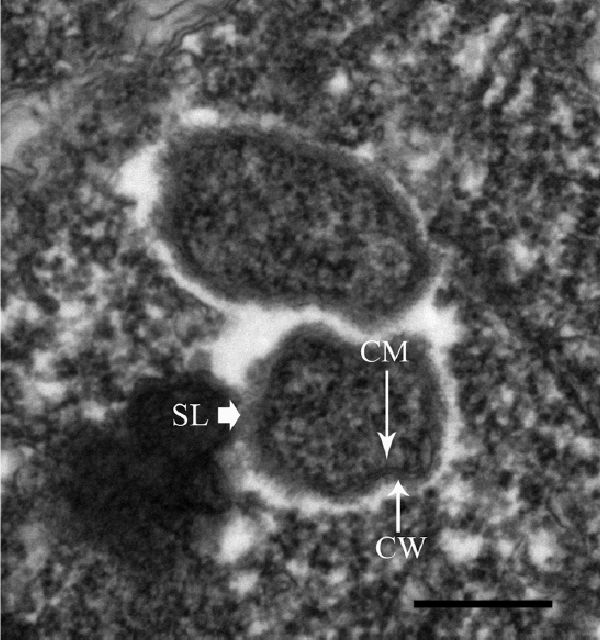 Трансмиссионная электронная микрофотография двух эндосимбионтов в теронте I. multifiliis штамма G13.