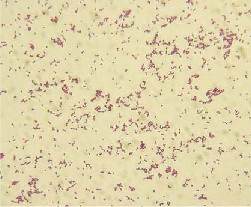 Окрашенные по Грамму бактерии Streptococcus iniae оскара