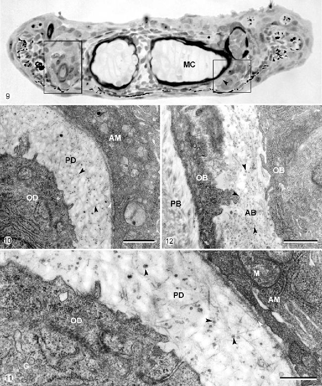 Микрофотографии световой и просвечивающей электронной микроскопии (Рисунок 10, 11, 12) зубов или зубных зачатков на челюсти головных эксплантов H. Bimaculatus